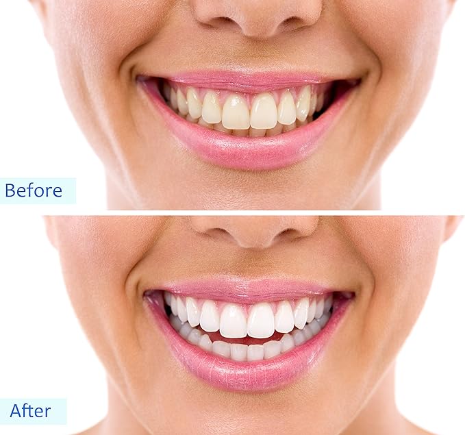 Activated Char coal Powder Teeth Whitening, Skin Detox, Facial Mask & Internal Cleanse- 60g - Binnoor Collection