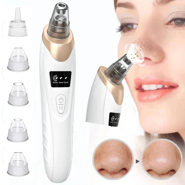 Electric Blackhead Remover Pore Vacuum Sucction machine - Binnoor Collection
