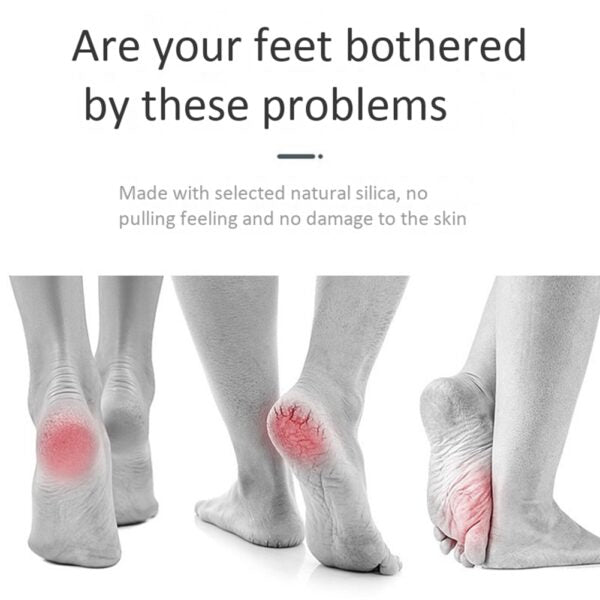 Find Back Electric Foot Vacuum Callus Remover - Binnoor Collection