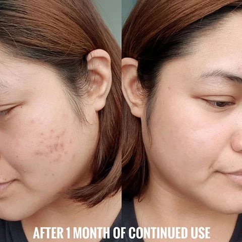 Night Cream For Bright, White And Clear Skin. - Binnoor Collection